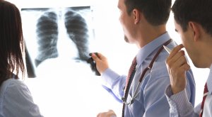 Cancro do Pulmão - Informação básica cancro do pulmão - cancro online