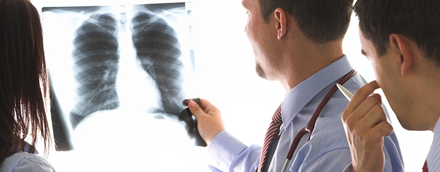 cancro do pulmão - cancro online
