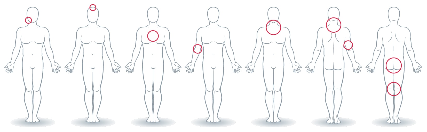 Melanoma - Conselhos úteis - Verificação e identificação de sinais e lesões