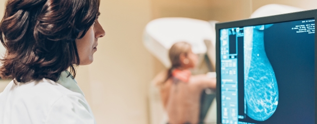 O que é Cancro da Mama - Cancro Online