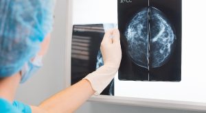 Diagnostico Cancro da Mama - Cancro Online