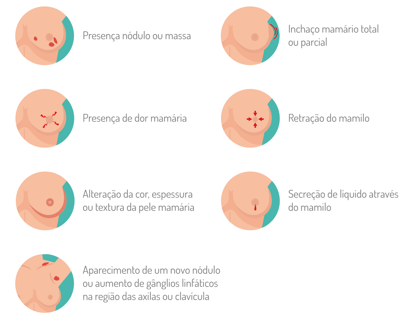 Regla sin ovulacion sintomas Regla sin ovulacion sintomas