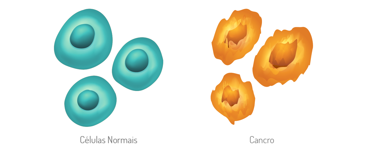 Cancro Colorretal